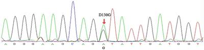 Case report: Prenatal diagnosis of fetal non-compaction cardiomyopathy with bradycardia accompanied by de novo CALM2 mutation